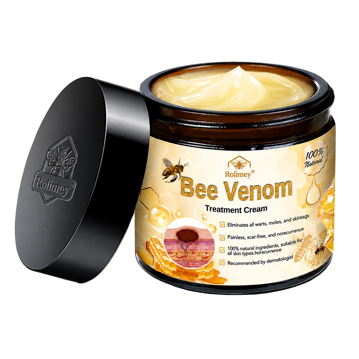 🔥Rolimey® Bee Venom Skin Treatment Cream - (Helping with acne, wart, rosacea, psoriasis, age spots, eczema, and reducing the appearance of stretch marks)