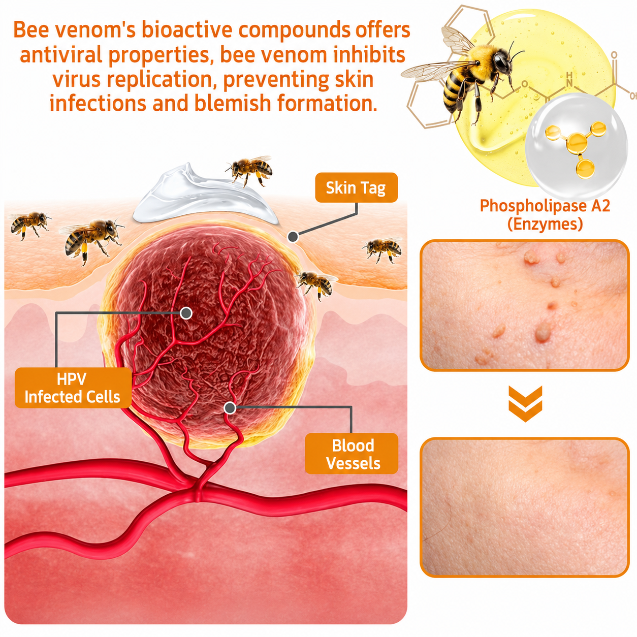 🔥Rolimey® Bee Venom Skin Treatment Cream - (Helping with acne, wart, rosacea, psoriasis, age spots, eczema, and reducing the appearance of stretch marks)