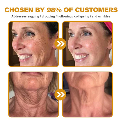 💎 Rolimey® Bee venom Pro Comprehensive Cream —Tightening for Skin Types