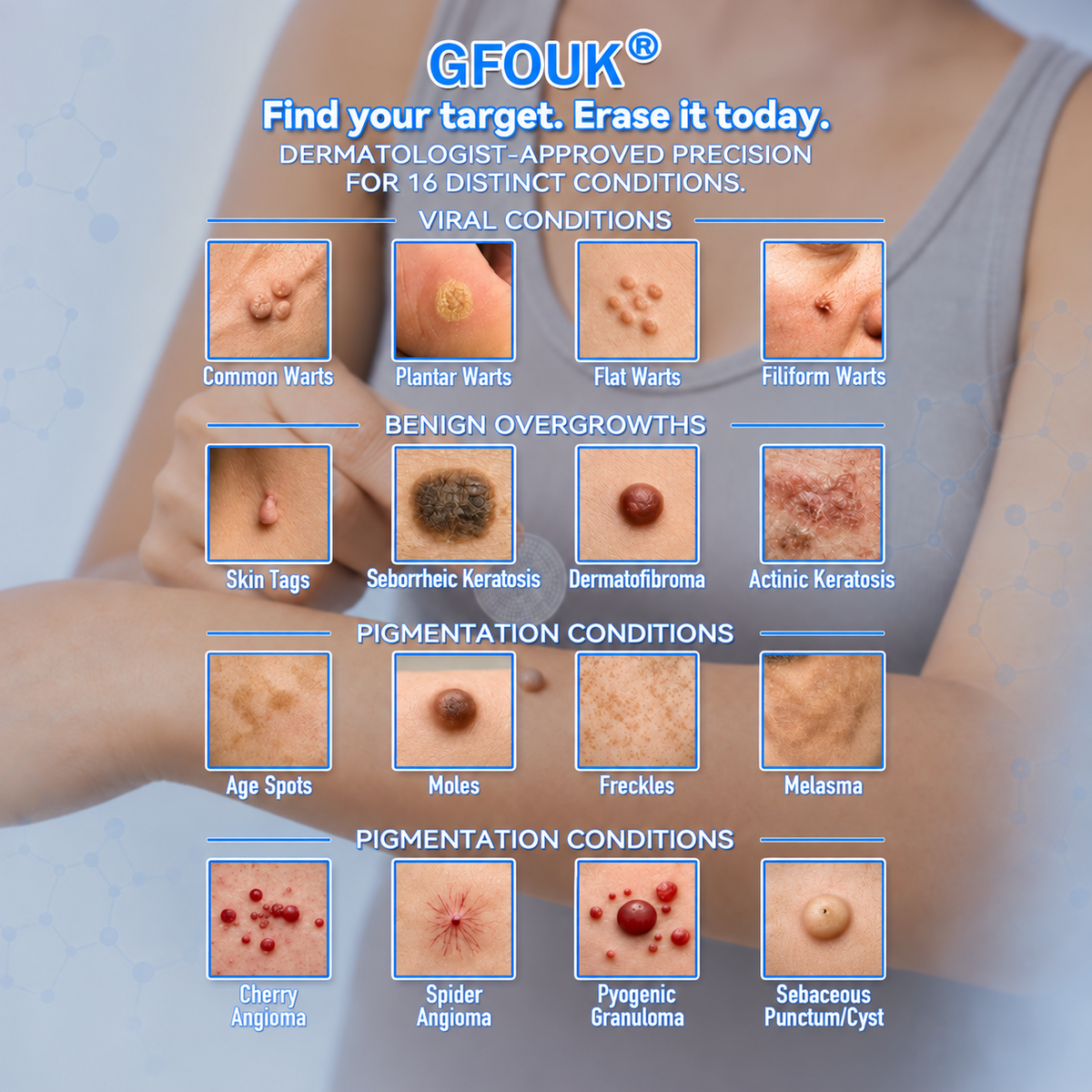 🌟 𝐎𝐟𝐟𝐢𝐜𝐢𝐚𝐥 𝐒𝐭𝐨𝐫𝐞 | 🌿GFOUK®  𝐁𝐨𝐭𝐚𝐧𝐢𝐜𝐚𝐥 𝐌𝐢𝐜𝐫𝐨𝐧𝐞𝐞𝐝𝐥𝐞 𝐇𝐲𝐝𝐫𝐨𝐜𝐨𝐥𝐥𝐨𝐢𝐝 𝐏𝐚𝐭𝐜𝐡 (𝐅𝐨𝐫 𝐒𝐤𝐢𝐧 𝐓𝐚𝐠𝐬, 𝐒𝐦𝐚𝐥𝐥 𝐒𝐤𝐢𝐧 𝐆𝐫𝐨𝐰𝐭𝐡𝐬, 𝐖𝐚𝐫𝐭𝐬, 𝐌𝐨𝐥𝐞𝐬, 𝐀𝐠𝐞 𝐒𝐩𝐨𝐭𝐬 & 𝐏𝐢𝐠𝐦𝐞𝐧𝐭𝐚𝐭𝐢𝐨𝐧 𝐂𝐨𝐧𝐜𝐞𝐫𝐧𝐬)