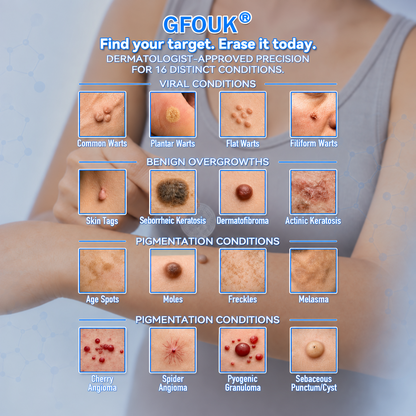 🌟 𝐎𝐟𝐟𝐢𝐜𝐢𝐚𝐥 𝐒𝐭𝐨𝐫𝐞 | 🌿GFOUK®  𝐁𝐨𝐭𝐚𝐧𝐢𝐜𝐚𝐥 𝐌𝐢𝐜𝐫𝐨𝐧𝐞𝐞𝐝𝐥𝐞 𝐇𝐲𝐝𝐫𝐨𝐜𝐨𝐥𝐥𝐨𝐢𝐝 𝐏𝐚𝐭𝐜𝐡 (𝐅𝐨𝐫 𝐒𝐤𝐢𝐧 𝐓𝐚𝐠𝐬, 𝐒𝐦𝐚𝐥𝐥 𝐒𝐤𝐢𝐧 𝐆𝐫𝐨𝐰𝐭𝐡𝐬, 𝐖𝐚𝐫𝐭𝐬, 𝐌𝐨𝐥𝐞𝐬, 𝐀𝐠𝐞 𝐒𝐩𝐨𝐭𝐬 & 𝐏𝐢𝐠𝐦𝐞𝐧𝐭𝐚𝐭𝐢𝐨𝐧 𝐂𝐨𝐧𝐜𝐞𝐫𝐧𝐬)