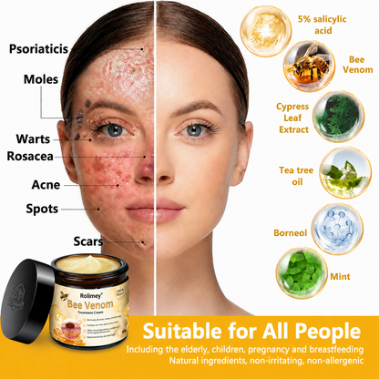 🔥Rolimey® Bee Venom Skin Treatment Cream - (Helping with acne, wart, rosacea, psoriasis, age spots, eczema, and reducing the appearance of stretch marks)