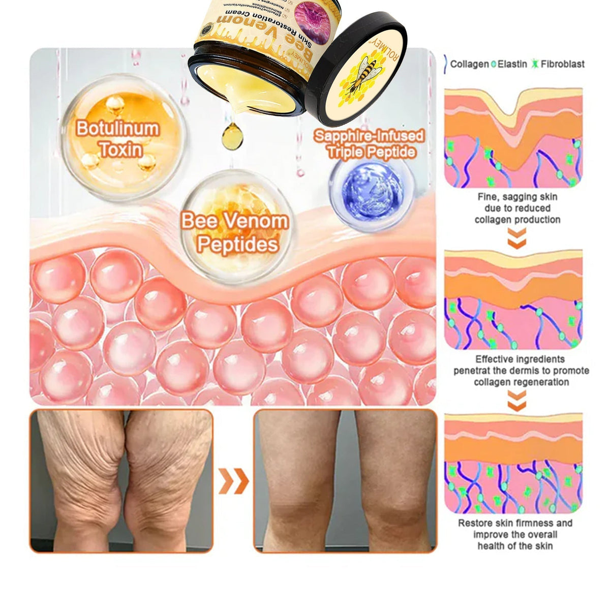 ☀️☀️Official Brand Shop丨Rolimey® 🐝Bee venom Pro Comprehensive Cream—Tightening for Skin Types