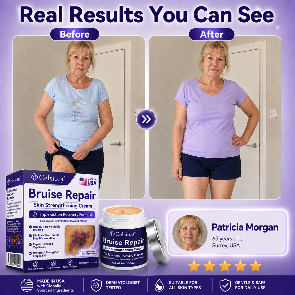 Rolimey® cream to repair bruises and strengthen the skin