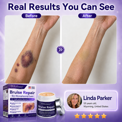Rolimey® cream to repair bruises and strengthen the skin