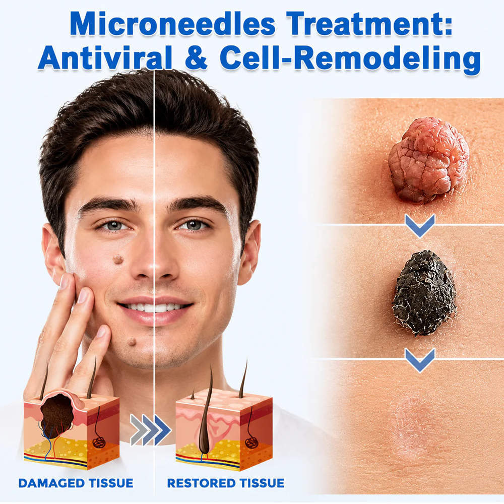 🎁GFOUK® 2-in-1 Microneedle & Hydrocolloid Patch