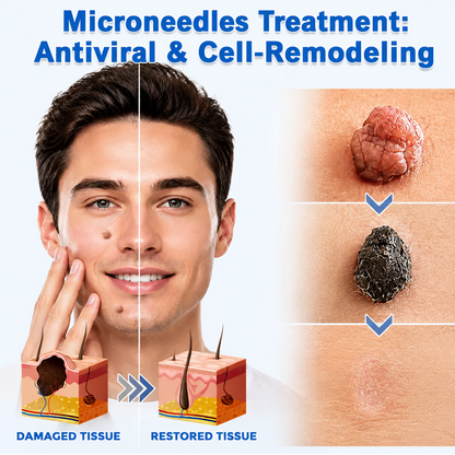 🎁GFOUK® 2-in-1 Microneedle & Hydrocolloid Patch