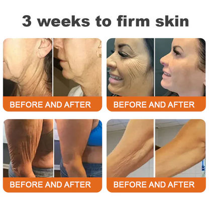 💎 Rolimey® Bee venom Pro Comprehensive Cream —Tightening for Skin Types