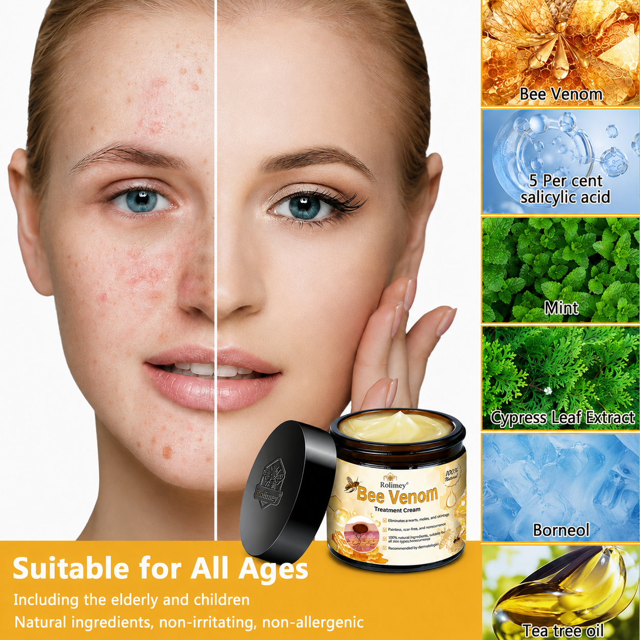 Rolimey® Bee Venom Skin Treatment Cream🔥🔥