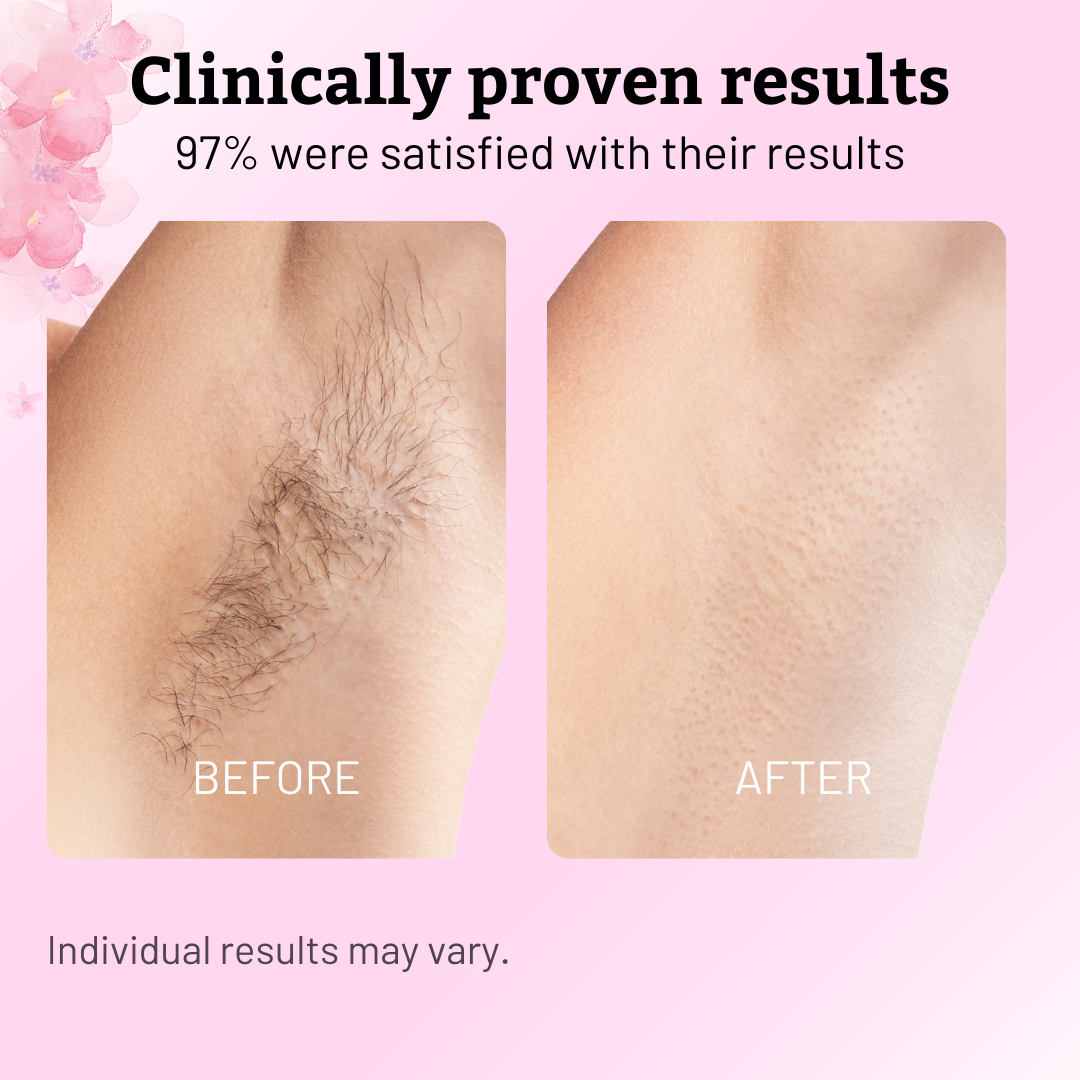 ✨Lustrely Beauty Cyperus Rotundus Oil:🎁 The Ultimate Natural Solution for Smooth, Healthy Skin