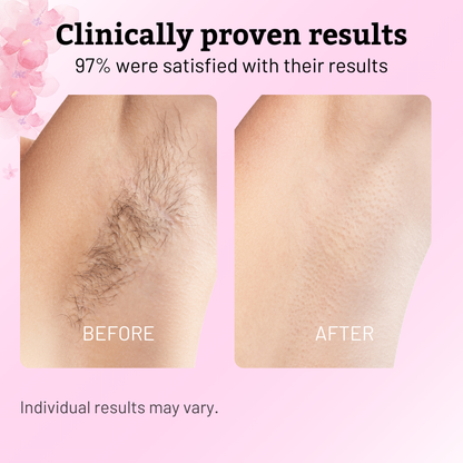 ✨Lustrely Beauty Cyperus Rotundus Oil:🎁 The Ultimate Natural Solution for Smooth, Healthy Skin