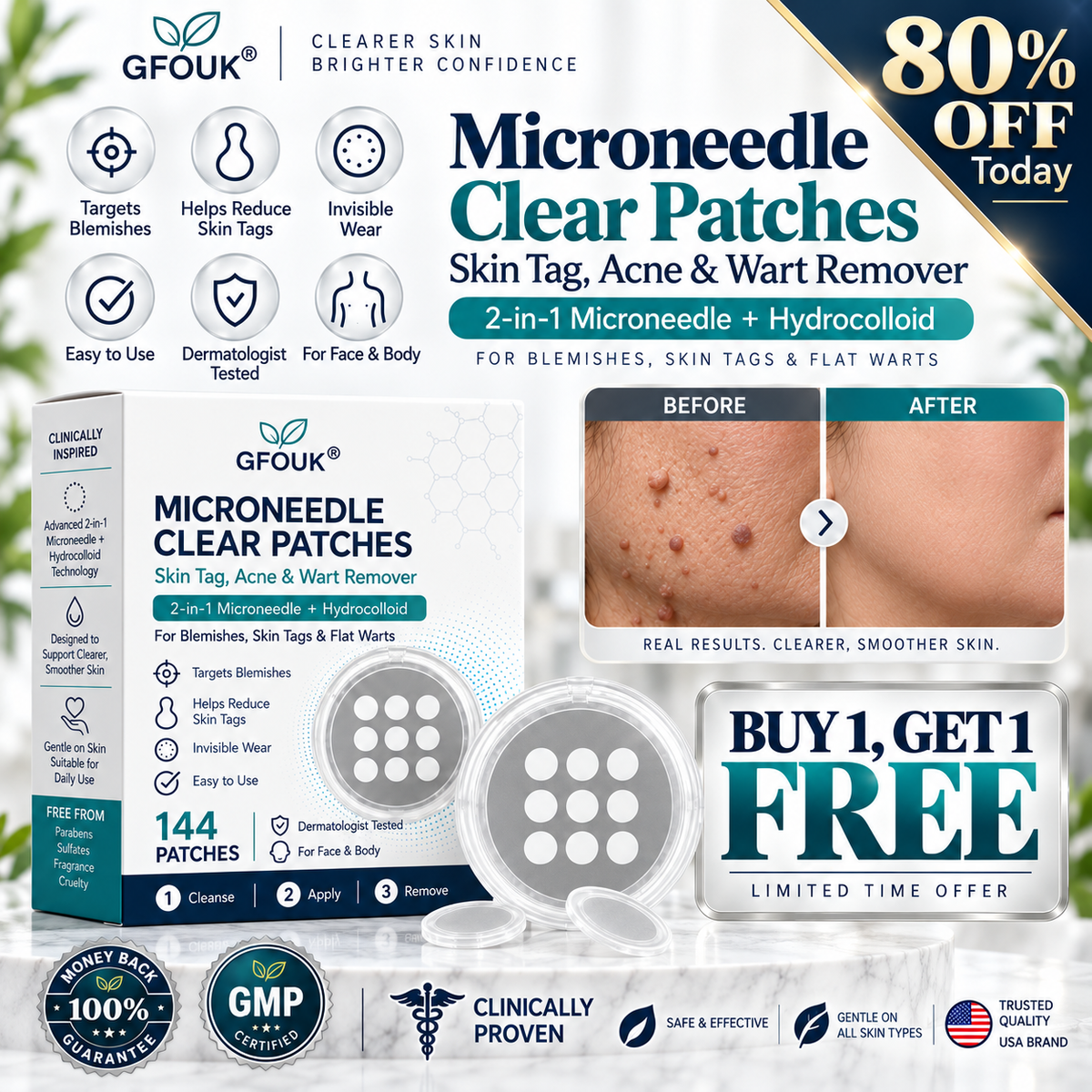 💦💦 𝐎𝐟𝐟𝐢𝐜𝐢𝐚𝐥 𝐒𝐭𝐨𝐫𝐞 | GFOUK®  👩‍⚕️𝐁𝐨𝐭𝐚𝐧𝐢𝐜𝐚𝐥 𝐌𝐢𝐜𝐫𝐨𝐧𝐞𝐞𝐝𝐥𝐞 𝐇𝐲𝐝𝐫𝐨𝐜𝐨𝐥𝐥𝐨𝐢𝐝 𝐏𝐚𝐭𝐜𝐡 (𝐅𝐨𝐫 𝐒𝐤𝐢𝐧 𝐓𝐚𝐠𝐬, 𝐒𝐦𝐚𝐥𝐥 𝐒𝐤𝐢𝐧 𝐆𝐫𝐨𝐰𝐭𝐡𝐬, 𝐖𝐚𝐫𝐭𝐬, 𝐌𝐨𝐥𝐞𝐬, 𝐀𝐠𝐞 𝐒𝐩𝐨𝐭𝐬 & 𝐏𝐢𝐠𝐦𝐞𝐧𝐭𝐚𝐭𝐢𝐨𝐧 𝐂𝐨𝐧𝐜𝐞𝐫𝐧𝐬)