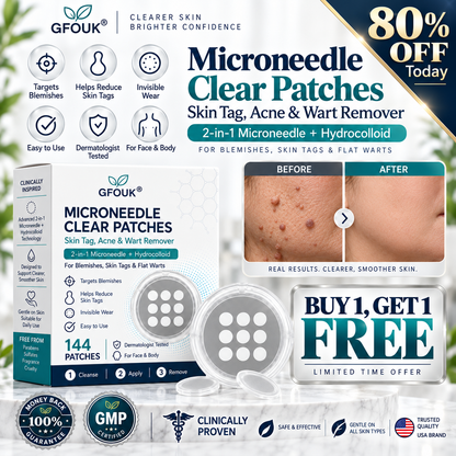 💦💦 𝐎𝐟𝐟𝐢𝐜𝐢𝐚𝐥 𝐒𝐭𝐨𝐫𝐞 | GFOUK®  👩‍⚕️𝐁𝐨𝐭𝐚𝐧𝐢𝐜𝐚𝐥 𝐌𝐢𝐜𝐫𝐨𝐧𝐞𝐞𝐝𝐥𝐞 𝐇𝐲𝐝𝐫𝐨𝐜𝐨𝐥𝐥𝐨𝐢𝐝 𝐏𝐚𝐭𝐜𝐡 (𝐅𝐨𝐫 𝐒𝐤𝐢𝐧 𝐓𝐚𝐠𝐬, 𝐒𝐦𝐚𝐥𝐥 𝐒𝐤𝐢𝐧 𝐆𝐫𝐨𝐰𝐭𝐡𝐬, 𝐖𝐚𝐫𝐭𝐬, 𝐌𝐨𝐥𝐞𝐬, 𝐀𝐠𝐞 𝐒𝐩𝐨𝐭𝐬 & 𝐏𝐢𝐠𝐦𝐞𝐧𝐭𝐚𝐭𝐢𝐨𝐧 𝐂𝐨𝐧𝐜𝐞𝐫𝐧𝐬)