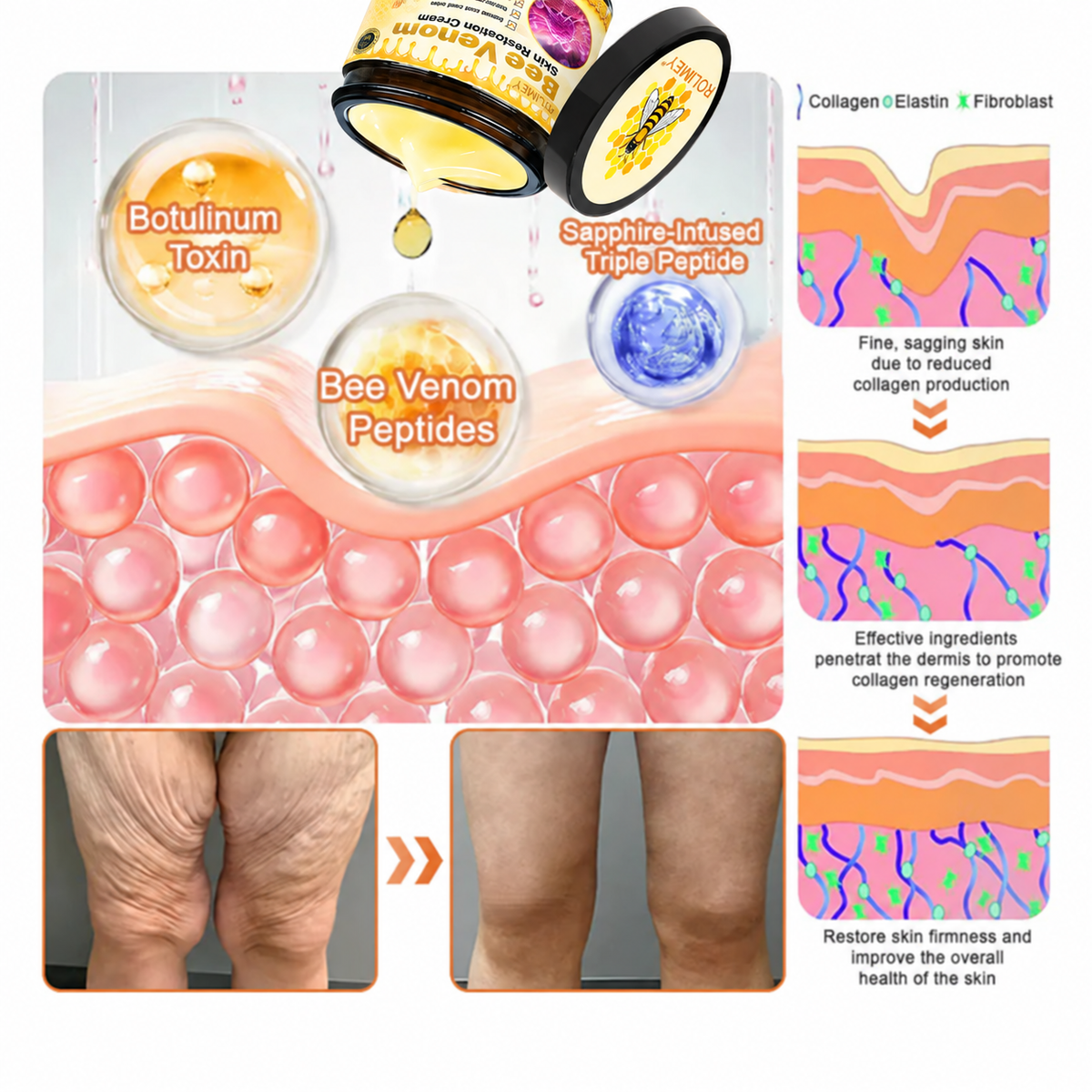 🌟Official Brand Shop丨Rolimey® 🐝Bee venom Pro Comprehensive Cream—Tightening for Skin Types